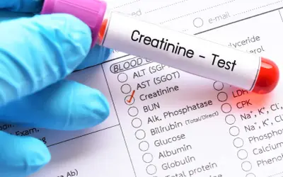 Rękawiczka w niebieskiej rękawicy trzyma probówkę z napisem "Creatinine - Test". Zaznaczono pole "Creatinine" na formularzu badań.