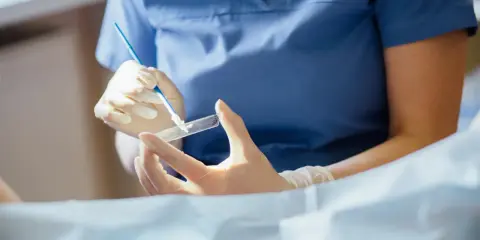 Lekarz w rękawiczkach przygotowuje preparat do badania cytologicznego, które pozwala wykryć zmiany w komórkach.