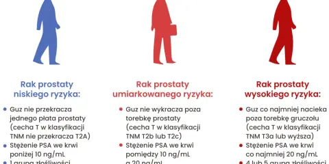 Ilustracja pokazuje trzy sylwetki mężczyzn, symbolizujące różne stadia raka prostaty: niskiego, umiarkowanego i wysokiego ryzyka. Opisuje, jak wygląda badanie prostaty w zależności od stopnia zaawansowania.