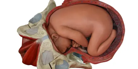 Model anatomiczny pokazuje, jak wygląda pochwa przed porodem, z główką dziecka wstawioną do miednicy.