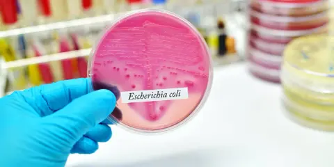 Różowa pożywka z koloniami bakterii Escherichia coli. Badanie pomaga wykryć bakteria coli objawy.
