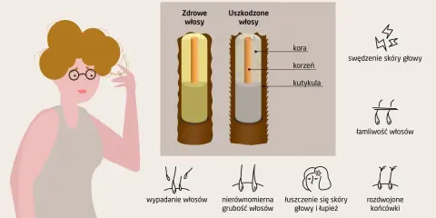 Ilustracja pokazuje porównanie zdrowych i uszkodzonych włosów, podkreślając łamliwość włosów i inne problemy.