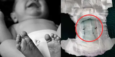 Dziecko w pampersie, obok zużyta pielucha z zielonym wkładem i ciemnymi grudkami.