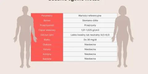 Tabela z wynikami badania ogólnego moczu: parametry, wartości referencyjne, barwa, przejrzystość, ciężar właściwy, odczyn, białko, glukoza, ketony, azotyny, bakterie.
