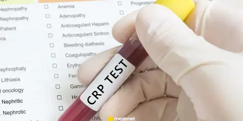 Ręka w rękawiczce trzyma probówkę z krwią z napisem "CRP TEST" na tle listy badań.