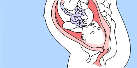Ein Baby in 35 ssw liegt mit dem Kopf nach unten im Mutterleib, bereit für die Geburt.