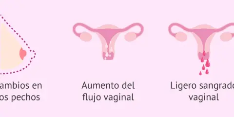 Cambios en pechos, aumento de flujo vaginal y ligero sangrado vaginal. Posible retraso menstrual.
