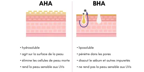 Comparaison AHA et BHA : l'un agit en surface, l'autre pénètre les pores pour dissoudre le sébum. Aha, le BHA est liposoluble !