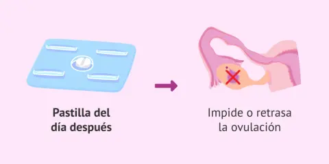 Pastilla del día después: su efecto es impedir o retrasar la ovulación, lo que puede afectar tu ciclo menstrual.