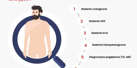 Ilustracja przedstawia schemat diagnozowania raka jąder. Wymienione badania to: urologiczne, USG, krwi, histopatologiczne, pogłębiona diagnostyka (TK, MR) i molekularne.