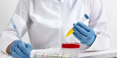 Laborantka w niebieskich rękawiczkach analizuje próbkę moczu, notując wyniki. Ciężar właściwy moczu 1,005 jest kluczowy.