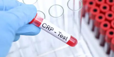 Ręka w niebieskiej rękawiczce trzyma probówkę z napisem "CRP - Test". W tle stoją inne probówki.