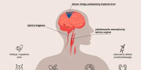 Ilustracja przedstawia przyczyny zawrotów głowy: blokadę tętnicy szyjnej, problemy z tętnicą kręgową, choroby mózgu, infekcje ucha, zaburzenia metaboliczne, sercowo-naczyniowe, układu przedsionkowego i działania niepożądane leków.