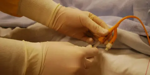 Ręce w rękawiczkach przygotowują się, by opróżnić worek na mocz z zaworem poprzecznym.