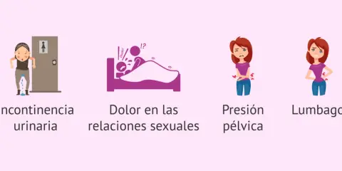 Ilustraciones de incontinencia, dolor en las relaciones sexuales, presión pélvica y lumbago, síntomas asociados al prolapso uterino.