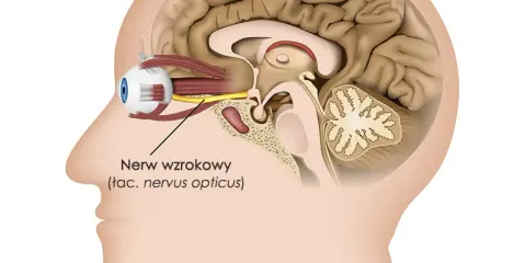 Przekrój głowy ukazujący oko i mózg. Widoczny jest nerw wzrokowy, łączący oko z mózgiem.
