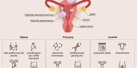 Ilustracja przedstawia budowę macicy z mięśniakami, objawy, przyczyny i leczenie, w tym c54 nowotwór złośliwy trzonu macicy.