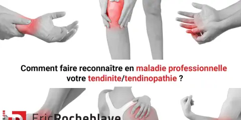 Douleurs articulaires (poignet, genou, doigt, épaule, coude) : comment faire reconnaître votre tendinite en maladie professionnelle.
