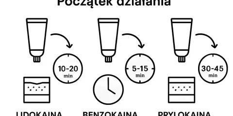 Porównanie czasu działania: lidokaina (10-20 min), benzokaina (5-15 min), prylokaina (30-45 min).