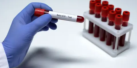 Ręka w niebieskiej rękawiczce trzyma probówkę z krwią do badania Beta hCG – test ciążowy z krwi. W tle stojak z innymi próbkami.
