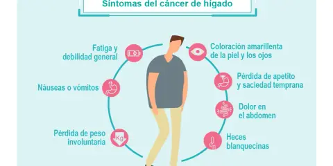 ¿Cáncer de hígado? Conoce sus síntomas y actúa a tiempo