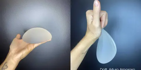 Protesi ergonomiche prima e dopo: un confronto visivo. La mano sinistra mostra una protesi rotonda, la destra una protesi a goccia.