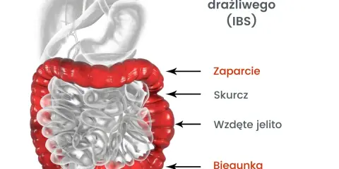 Jelito drażliwe: Objawy, typy, czerwone flagi. Kiedy do lekarza?