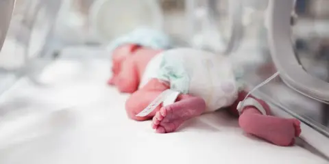 Un bebé prematuro duerme en una incubadora de bebés, con pulseras de identificación en sus tobillos.