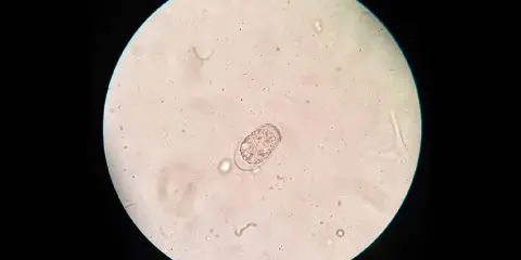 Mikroskopische Aufnahme eines Kokzidien-Oozysten, typisch für Kokzidiose bei Kaninchen.