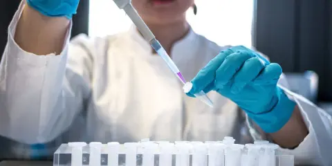 Ricerca per la terapia monoclonale: una mano guantata usa un contagocce per trasferire un liquido viola in una provetta, parte di un esperimento in laboratorio.