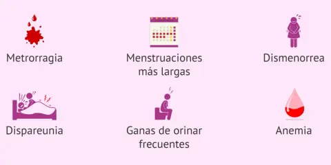 Síntomas como metrorragia, dismenorrea o dispareunia pueden indicar qué es un mioma.