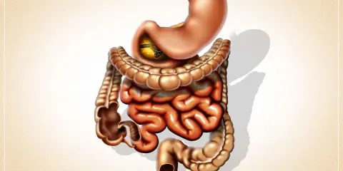 Ilustracja przedstawiająca żołądek i jelita, z widocznym żółtym fragmentem w żołądku.