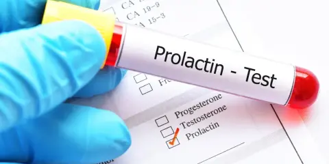 Hiperprolaktynemia: objawy, diagnostyka i jak obniżyć prolaktynę?