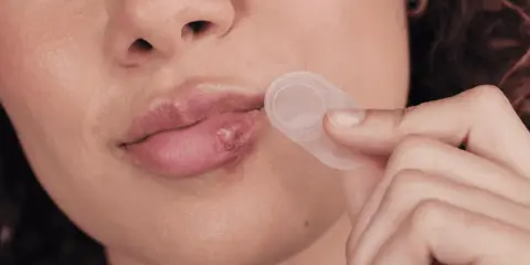 Dłoń zbliża plaster na opryszczkę do ust z widoczną zmianą.