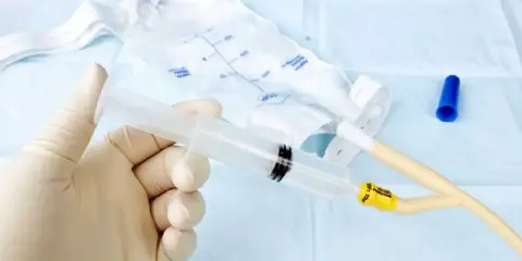 Rękawiczka przygotowuje cewnik do pęcherza moczowego przez powłoki brzuszne. Obok worek na mocz i niebieska zatyczka.