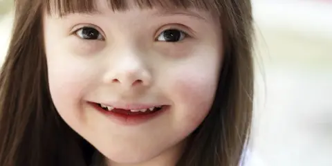 Niña sonriente con síndrome de Down, una condición que no define su luz.