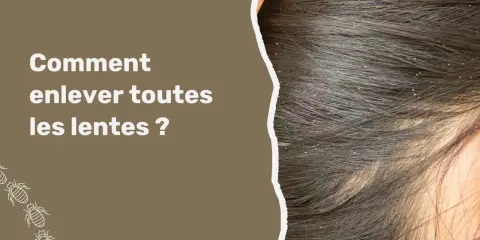 Gros plan sur des cheveux sombres infestés de lentes. Le texte "Comment enlever toutes les lentes ?" apparaît à gauche, avec des illustrations de poux en bas.