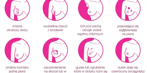 Grafika pokazuje objawy raka piersi: guzek, zmiany skórne, wydzielinę z brodawki, ból, wgłębienia, asymetrię, zaczerwienienie i odwrócony sutek.