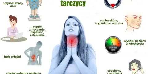 Niedoczynność tarczycy: objawy psychiczne to wahania nastroju, rozdrażnienie, problemy z pamięcią i koncentracją.