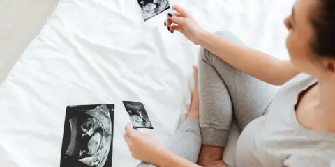 Kobieta w ciąży ogląda zdjęcia USG płodu na białym łóżku.