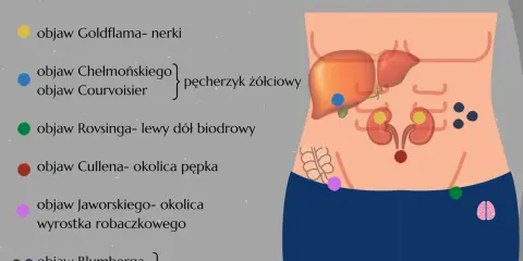 Ilustracja przedstawia schemat jamy brzusznej z zaznaczonymi organami i punktami odpowiadającymi objawom chorobowym.