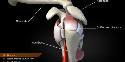 Anatomie de l'épaule montrant la clavicule, l'humérus et la coiffe des rotateurs. Une rupture de la coiffe des rotateurs peut être une maladie professionnelle.