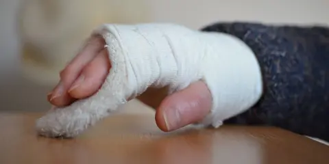 Złamany nadgarstek w bandażu. Czas rehabilitacji po złamaniu nadgarstka jest kluczowy dla powrotu do sprawności.