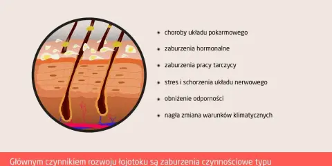 Przekrój skóry z widocznymi gruczołami łojowymi, które mogą powodować rany na skórze głowy z powodu łojotoku.
