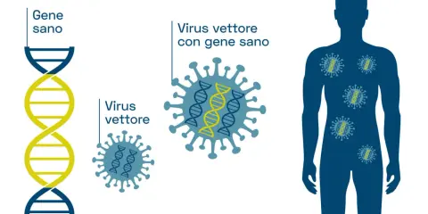 Illustrazione del processo di terapia genica: un gene sano viene inserito in un virus vettore, che poi entra in un corpo umano per correggere difetti genetici.