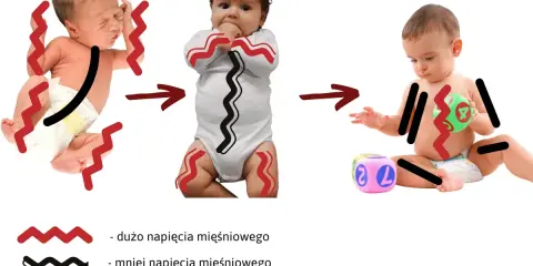 Trzy etapy rozwoju niemowlęcia: od wzmożonego napięcia mięśniowego, przez mniejsze, aż do swobodnych ruchów.