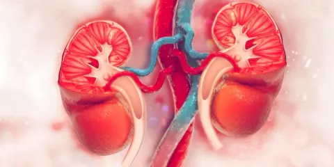 Przekrój nerek z widocznym ubytkiem miąższu nerki. Czerwone naczynia krwionośne i niebieskie żyły łączą się z organami.