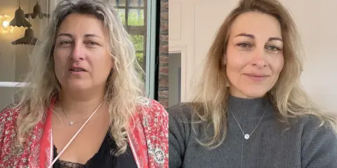 Avant/après : le visage s'affine visiblement après une perte de poids. La question "à partir de combien de kilos perd on du visage" trouve ici une réponse visuelle.