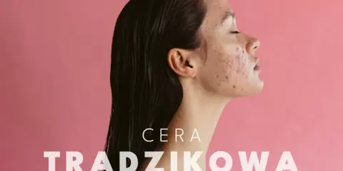 Cera trądzikowa: Jak dbać? Kompletny poradnik ekspertki