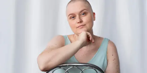 Kobieta po mastektomii, z łysą głową, opiera się o krzesło. Myśli o tym, jak uzyskać biustonosz po mastektomii refundacja.